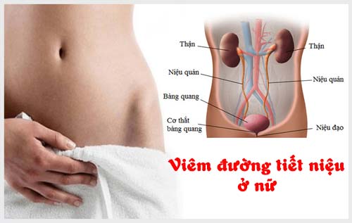 Tổng quan về viêm đường tiết niệu, viêm đường tiết niệu ở nữ giới có nguy hiểm không?