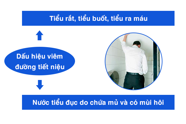 Viêm đường tiết niệu ở nam giới – Biến chứng phổ biến của bệnh u xơ tuyến tiền liệt